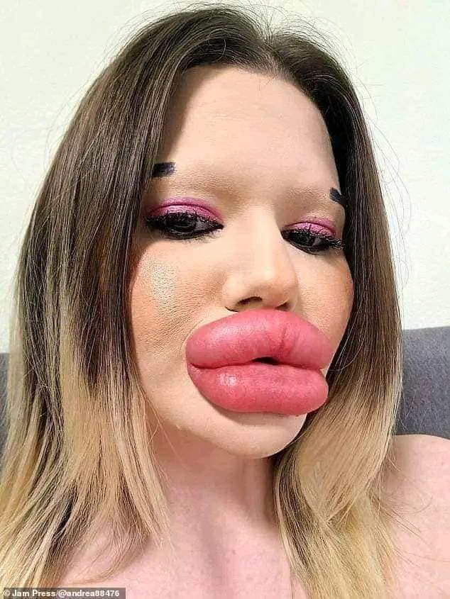 The individual boasting the largest lips on the planet!