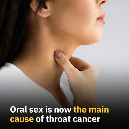 Oral sex is now the main cause of throat cancer