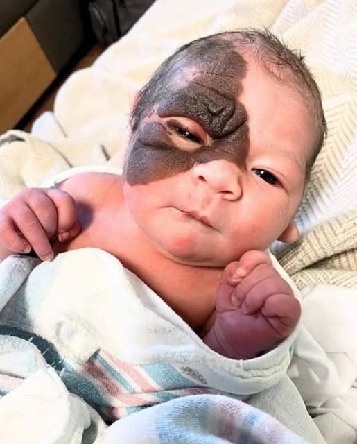 When Winry was born her ”Strange Birthmark” stunned people. Try not to smile when you see this brave girl today…